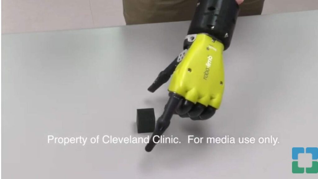 bioniczną protezę